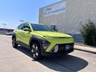 2024 Hyundai Kona SEL thumbnail image 01