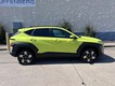 2024 Hyundai Kona SEL thumbnail image 02