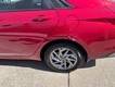 2024 Hyundai Elantra SEL thumbnail image 06