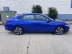2025 Hyundai Elantra SEL Sport thumbnail image 02