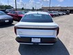 2025 Kia K4 LX thumbnail image 03
