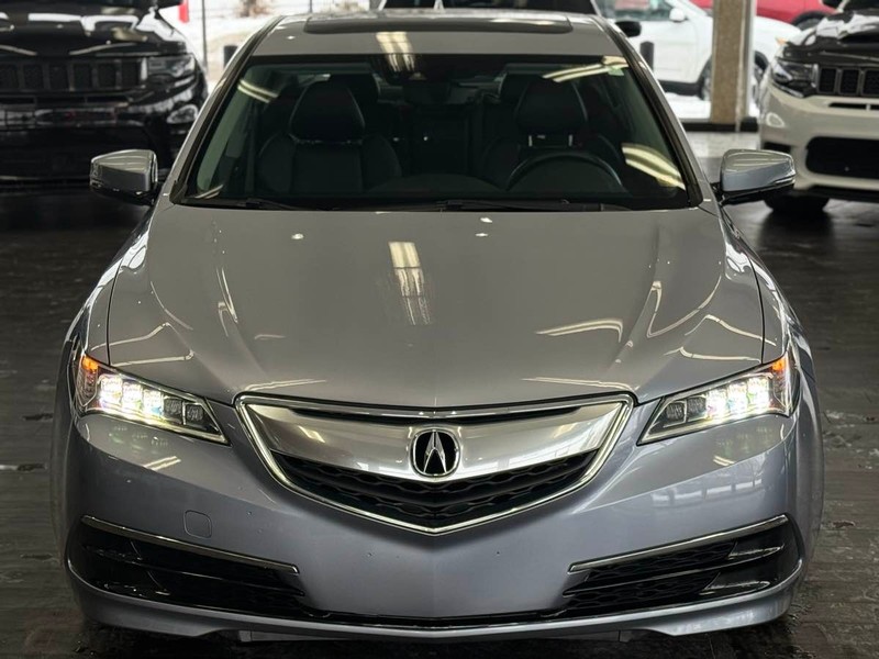 Acura TLX Vehicle Full-screen Gallery Image 03