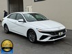 2024 Hyundai Elantra SEL thumbnail image 02