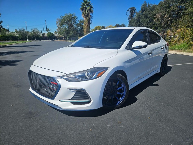 Hyundai Elantra Vehicle Full-screen Gallery Image 01