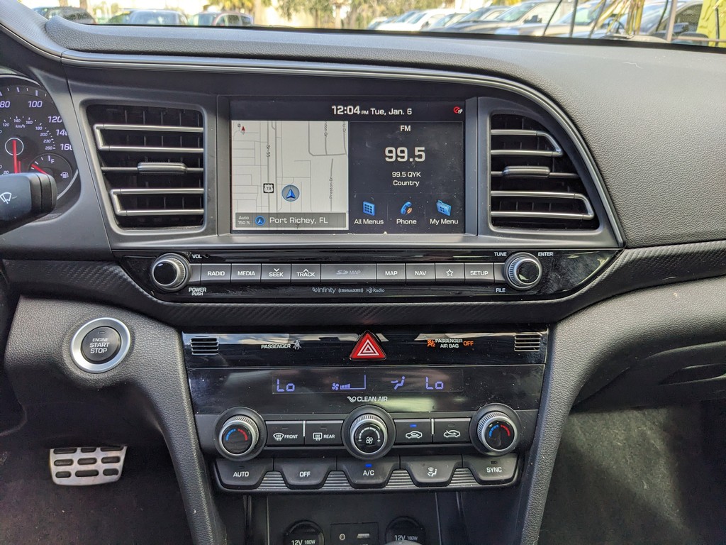 Hyundai Elantra Vehicle Full-screen Gallery Image 16