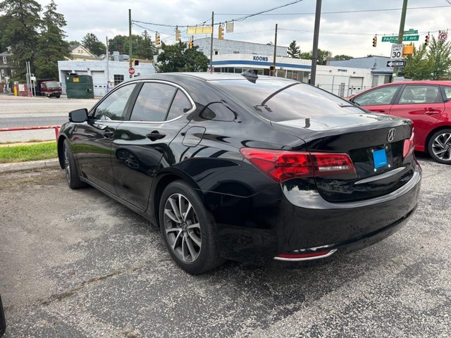2015 Acura TLX V6 Tech image 02