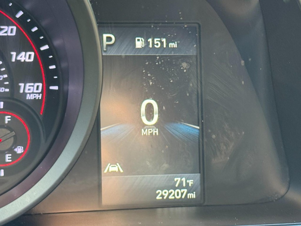 Hyundai Elantra Vehicle Full-screen Gallery Image 18